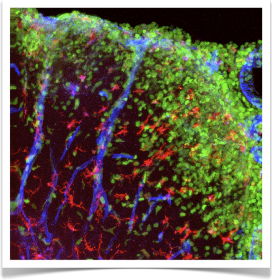 Monocytes